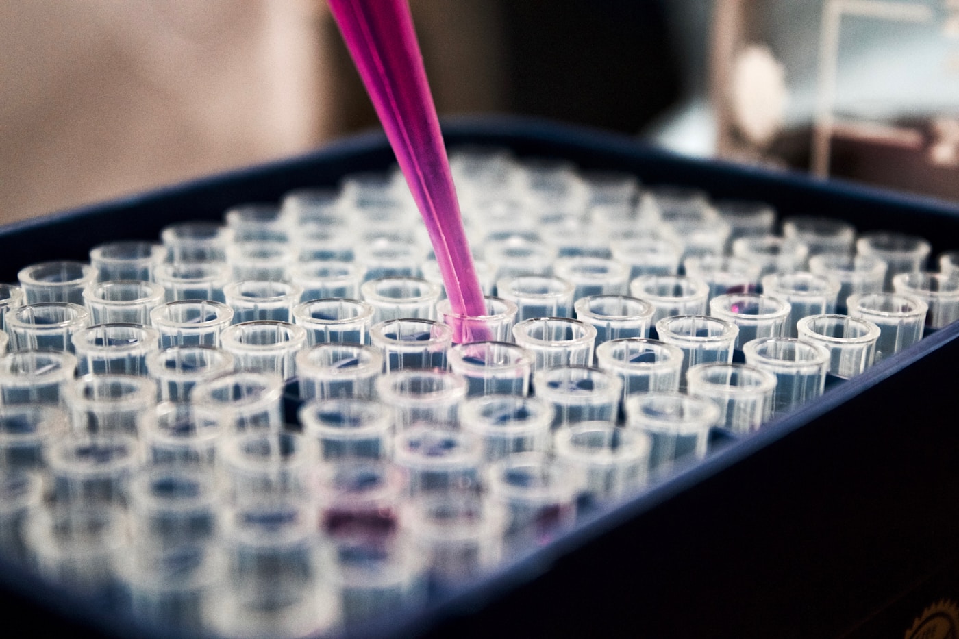 Laboratory samples being processed with a pipette